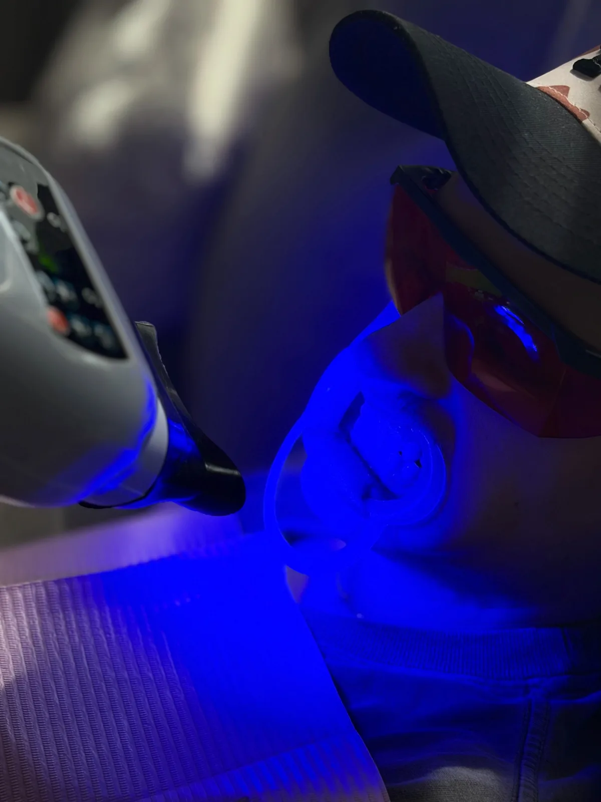 Client under the LED whitening lamp at ProElite Aesthetics